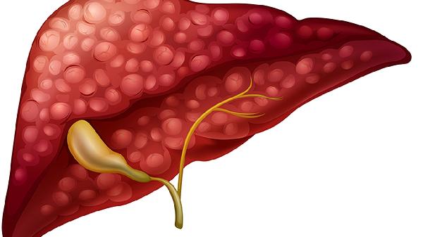 味觉是五脏六腑的“风向标”？不同滋味对应着不同疾病！